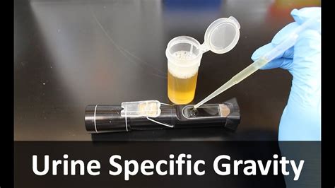 how to use a refractometer urinalysis|specific gravity urine refractometer high.